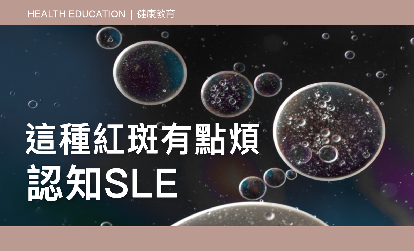 CAIPA Health Article - This Redness is a Bit Troublesome - Understanding SLE 這種紅斑有點煩——認知SLE