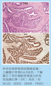 CAIPA Health Article - 大腸直腸癌和免疫腫瘤治療