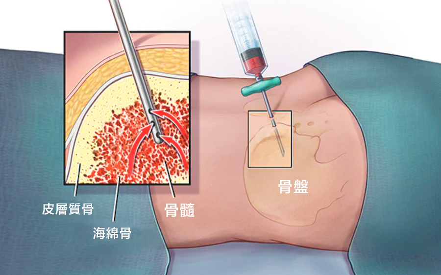 Health Article