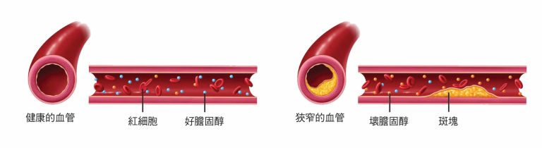 好壞膽固醇