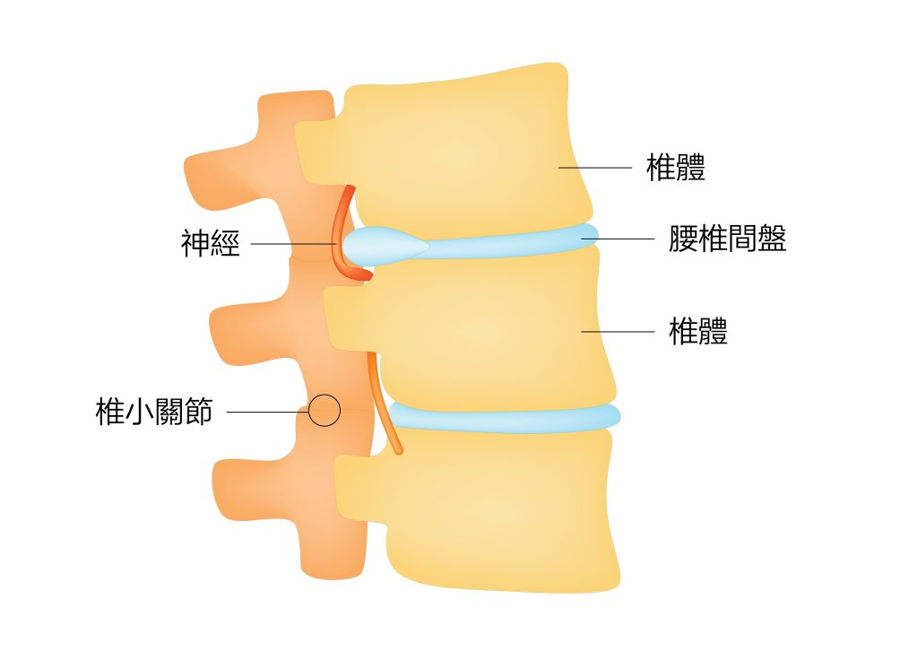 CHAMP - Pain Management 關節疼痛管理