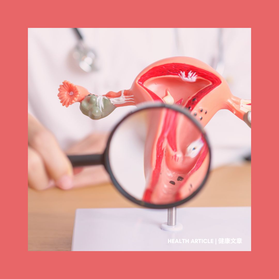 Health Article - 女性的隱形風險 子宮頸癌 The Hidden Risk: Cervical Cancer