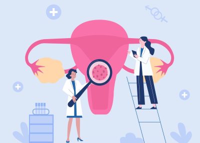 CHAMP | Cervical Cancer 子宮頸癌的治療
